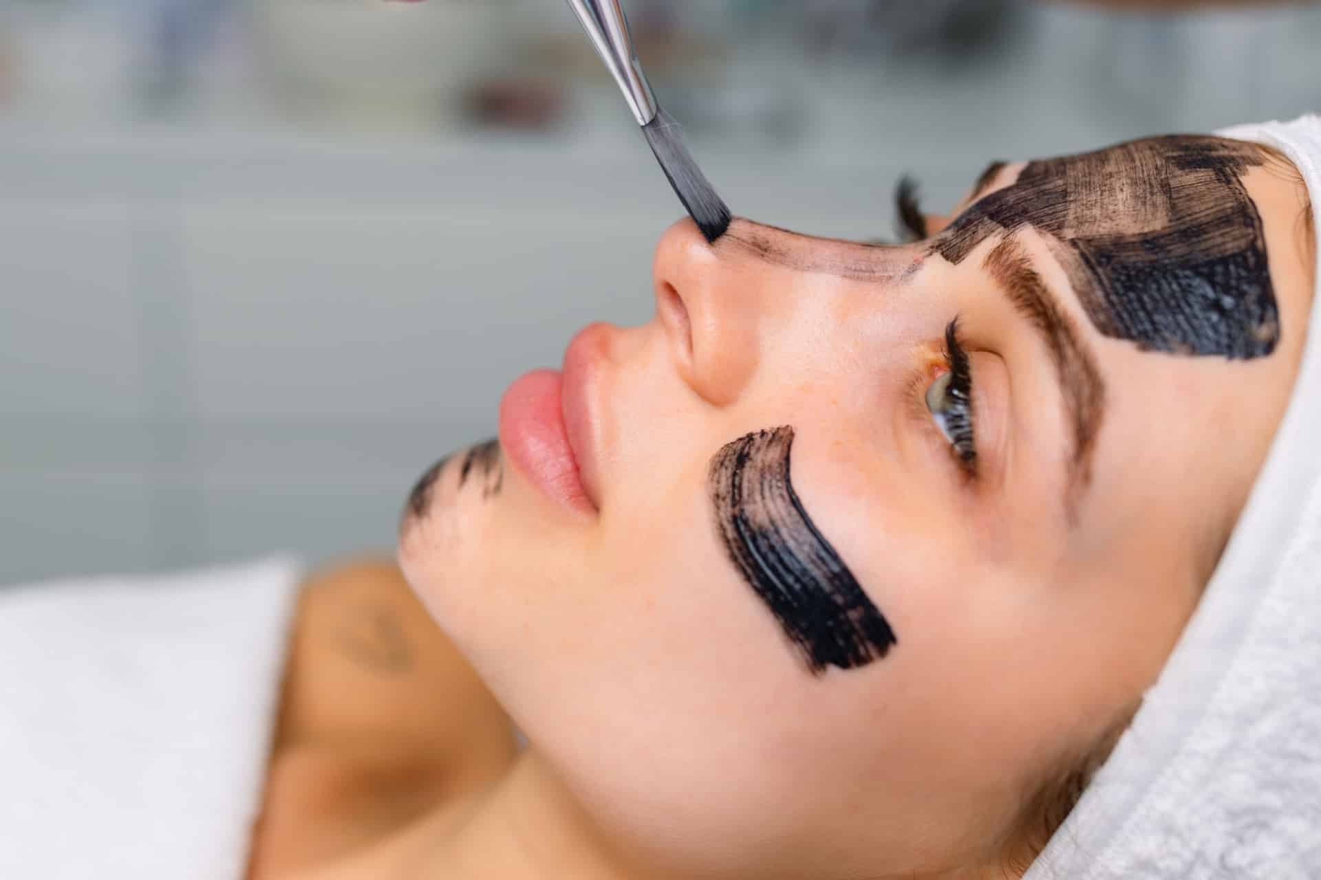 carbon-peel-1.jpg