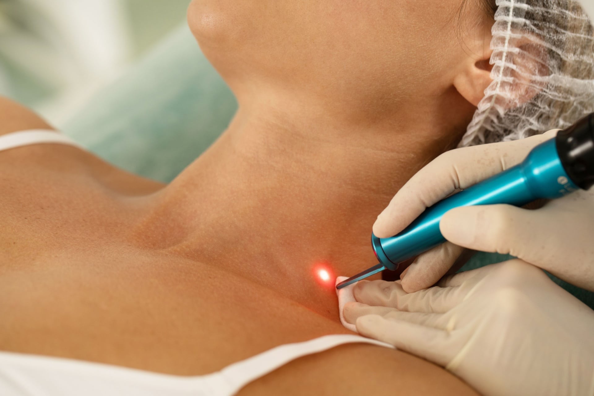 laser-pigmentering-1.jpg