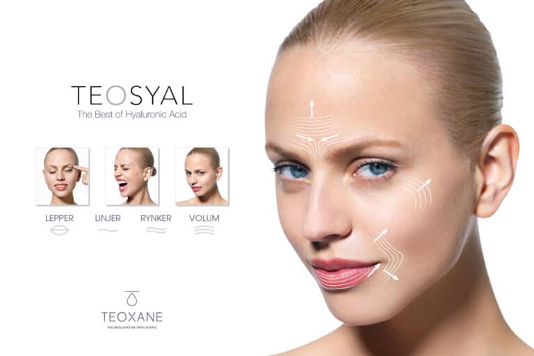 teosyal-filler.jpeg